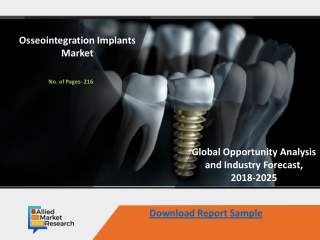 Osseointegration Implants Market Trends Estimates High Demand by 2025
