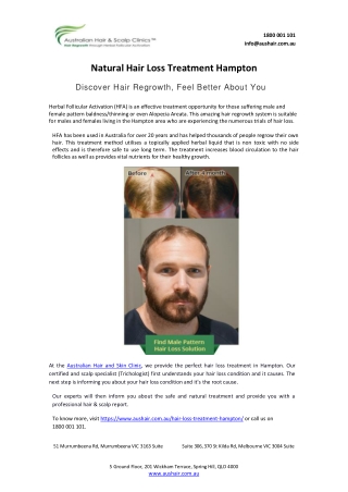 Natural Hair Loss Trearment Hampton