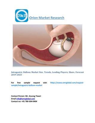 Intragastric Balloon Market Size, Trends, Leading Players, Share, Forecast 2019-2025