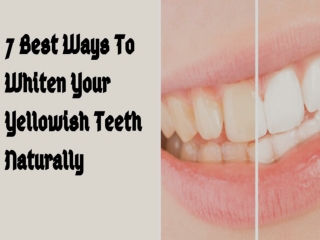 7 Best Ways to Whiten Your Yellowish Teeth Naturally