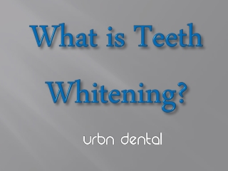 What is Teeth Whitening?