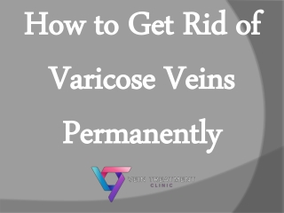 How to Get Rid of Varicose Veins Permanently?