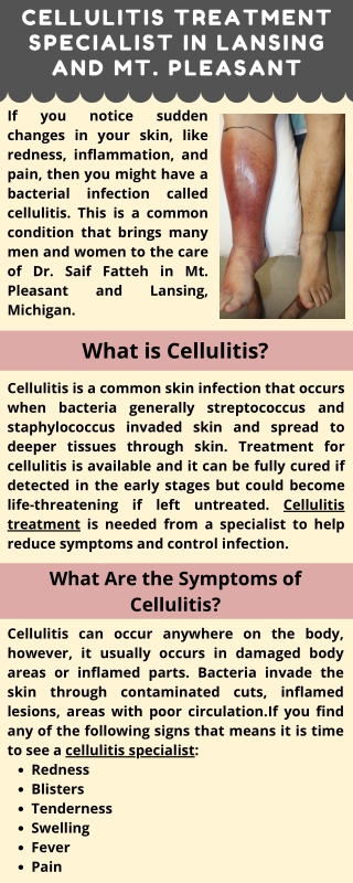 Cellulitis Treatment Specialist in Lansing and Mt. Pleasant