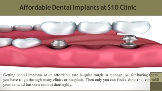 Affordable Dental Implants at S10 Clinic