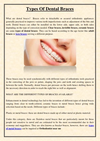 Types Of Dental Braces