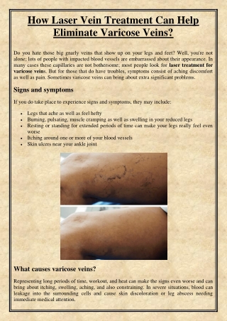 How Laser Vein Treatment Can Help Eliminate Varicose Veins?