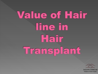 Value of Hair Line in Hair Transplant