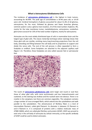 Astrocytoma Glioblastoma Cells