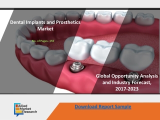 Dental Implants and Prosthetics Market