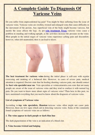A Complete Guide To Diagnosis Of Varicose Veins