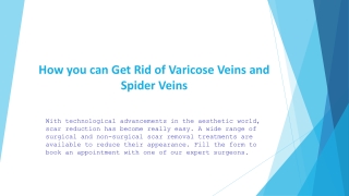 How you can Get Rid of Varicose Veins and Spider Veins