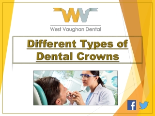 Different Types of Dental Crowns