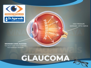 Glaucoma | Glaucoma Surgery, Glaucoma Eye Surgery Centre |  Glaucoma Center in Indore,