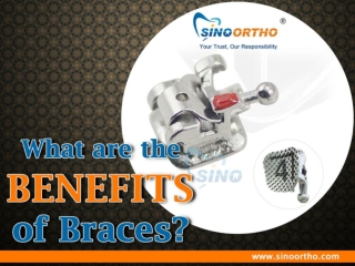 What are the benefits of braces