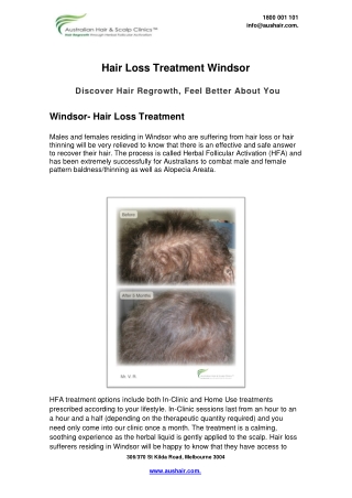 Hair Loss Treatment  Windsor