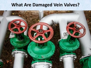 What Are Damaged Vein Valves?