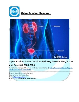 Japan Bladder Cancer Market Size, Share, Analysis, Industry Report and Forecast to 2026