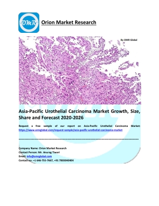 Asia-Pacific Urothelial Carcinoma Market Share, Trends, Size, Research and Forecast 2020-2026