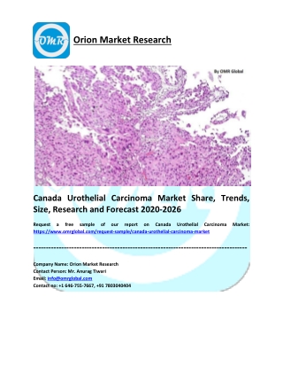 Canada Urothelial Carcinoma Market Size, Share, Growth, Research and Forecast 2020-2026