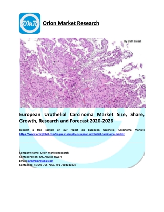 European Urothelial Carcinoma Market Growth, Size, Share and Forecast 2020-2026