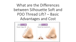 What are the differences between Silhouette Soft and PDO Thread Lift