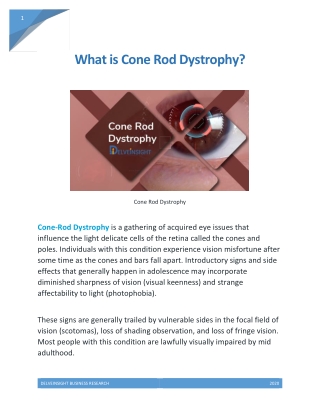 Cone Rod Dystrophy market analysis