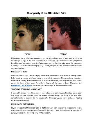 Rhinoplasty at an Affordable Price
