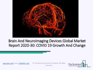 Global Brain And Neuroimaging Devices Market Report 2020-2030 | Covid 19 Growth And Change