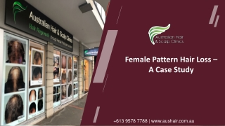 Female Pattern Hair Loss – A Case Study