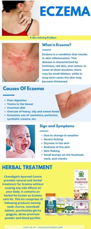 Eczema- Causes, Symptoms and Treatment