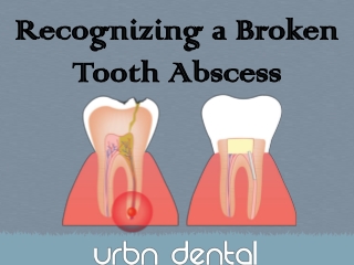 Find the Best Emergency Dental Extraction Dentist in Houston