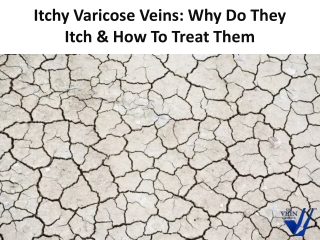 Itchy Varicose Veins: Why Do They Itch & How To Treat Them