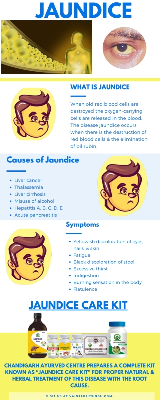 Jaundice - Causes, Symptoms and Herbal Treatment