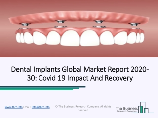 Dental Implants Market Set to Register robust CAGR During 2020-2023