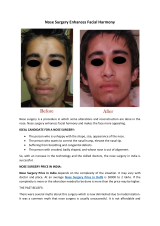 Nose Surgery Enhances Facial Harmony