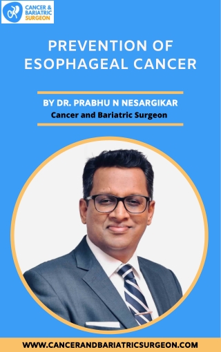 Prevention of Esophageal Cancer | Best Cancer Surgeon in Bangalore