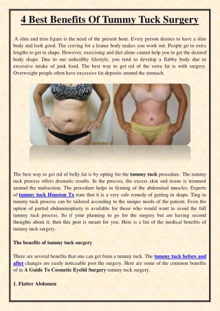 4 Best Benefits Of Tummy Tuck Surgery