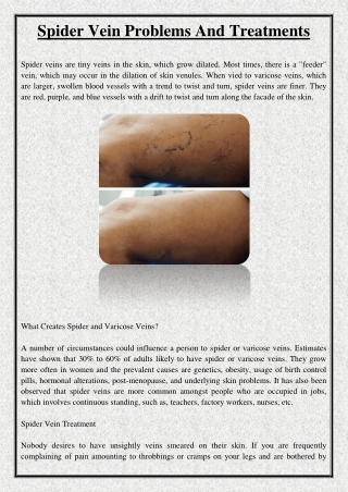 Spider Vein Problems And Treatments