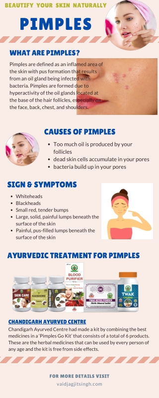 Pimples - Causes, Symptoms and Herbal Treatment