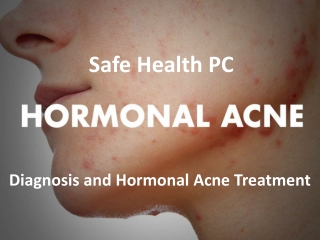 Best Dermatologist for Hormonal Acne in Michigan
