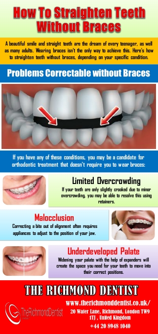 How To Straighten Teeth Without Braces