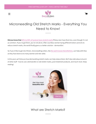 Microneedling Old Stretch Marks - Everything You Need to Know!