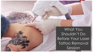 What You Shouldn’t Do Before Your Laser Tattoo Removal Session