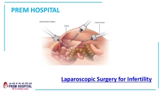 Laparoscopic Surgery for Infertility