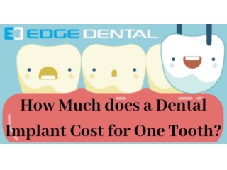 How Much Does a Dental Implant Cost For One Tooth