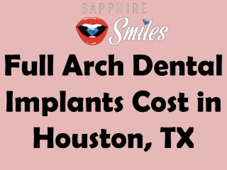 Full Arch Dental Implants Cost in Houston, TX