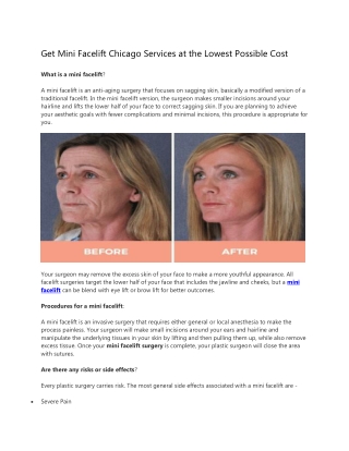 Get Mini Facelift Chicago Services at the Lowest Possible Cost