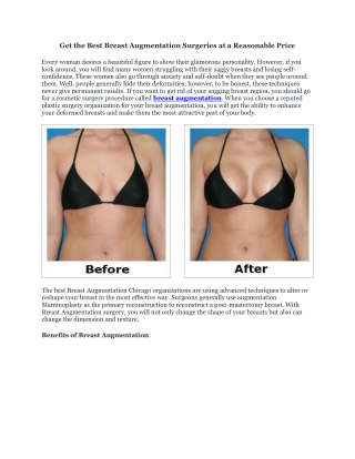 Get the Best Breast Augmentation Surgeries at a Reasonable Price