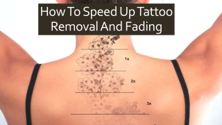 Speed Up Your Tattoo Removal Session