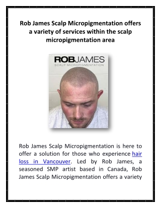 Rob James Scalp Micropigmentation offers a variety of services within the scalp micropigmentation area